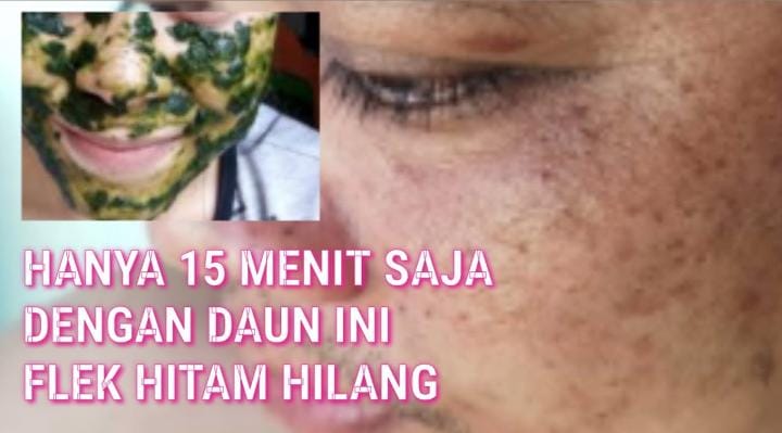 6 Daun Penghilang Flek Hitam Terbaik, Cara Alami Bikin Wajah Glowing Awet Muda Paling Mudah dan Aman