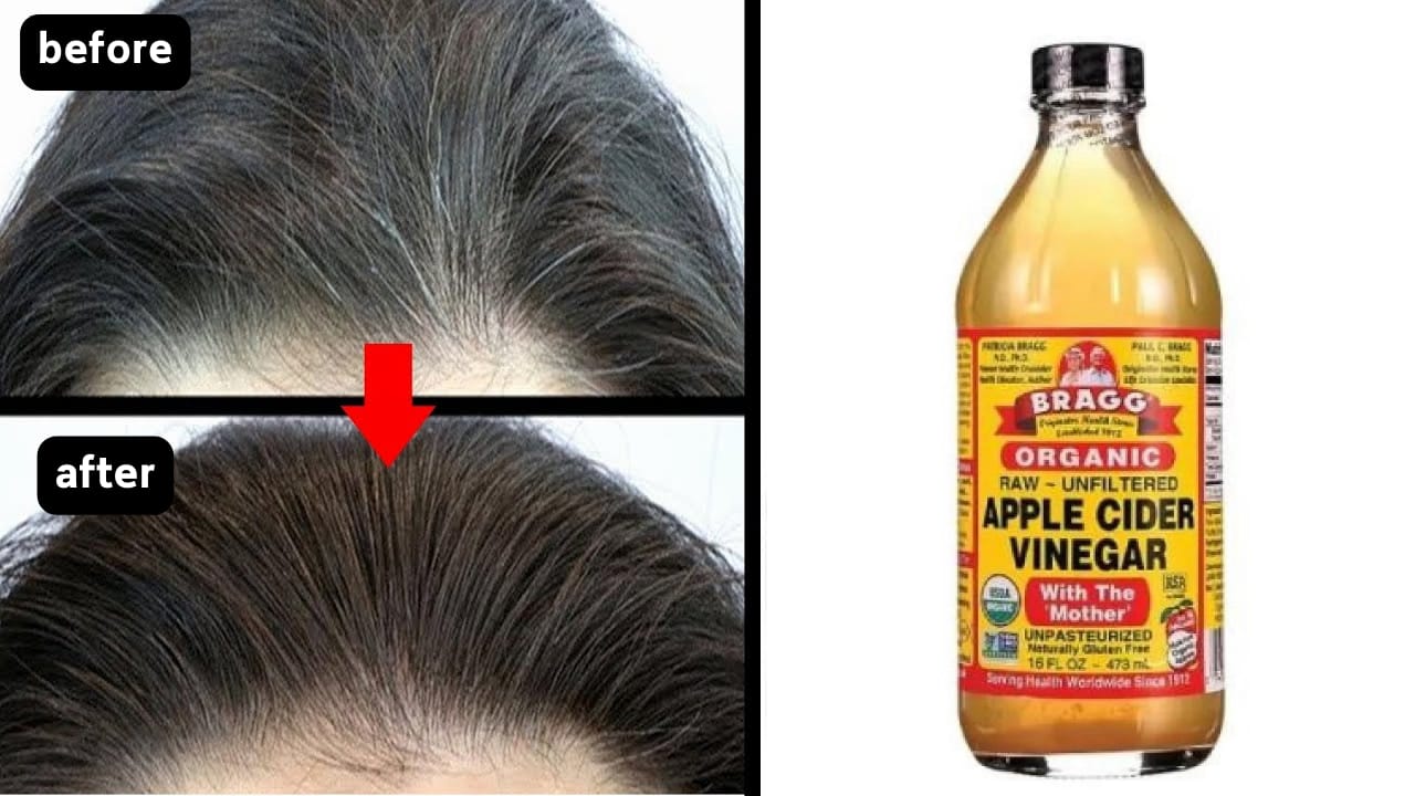 4 Manfaat Cuka Apel untuk Rambut Beruban, Begini Cara Pakainya Agar Rambut Hitam Permanen Sampai Ke Akarnya