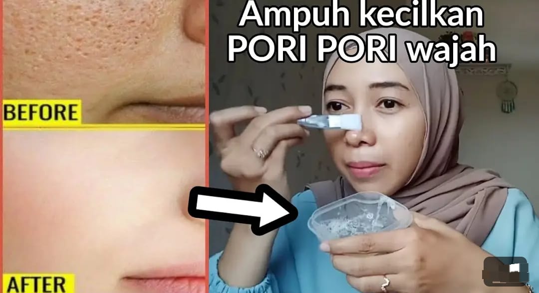 Kulit jadi Glowing Pakai Bahan Dapur, Inilah 4 Cara Instan Mengecilkan Pori-Pori Agar Wajah Mulus Permanen