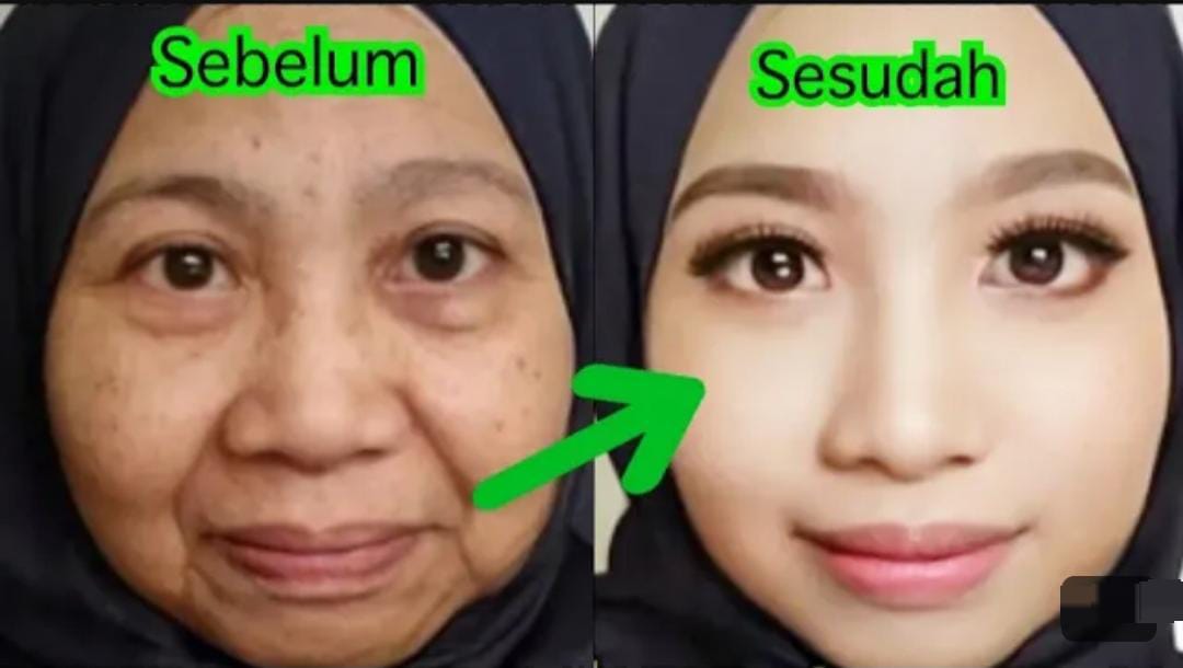 3 Bahan Dapur untuk Menghilangkan Flek Hitam Dalam 1 Malam, Wajah Langsung Mulus, Putih dan Glowing Bebas Noda