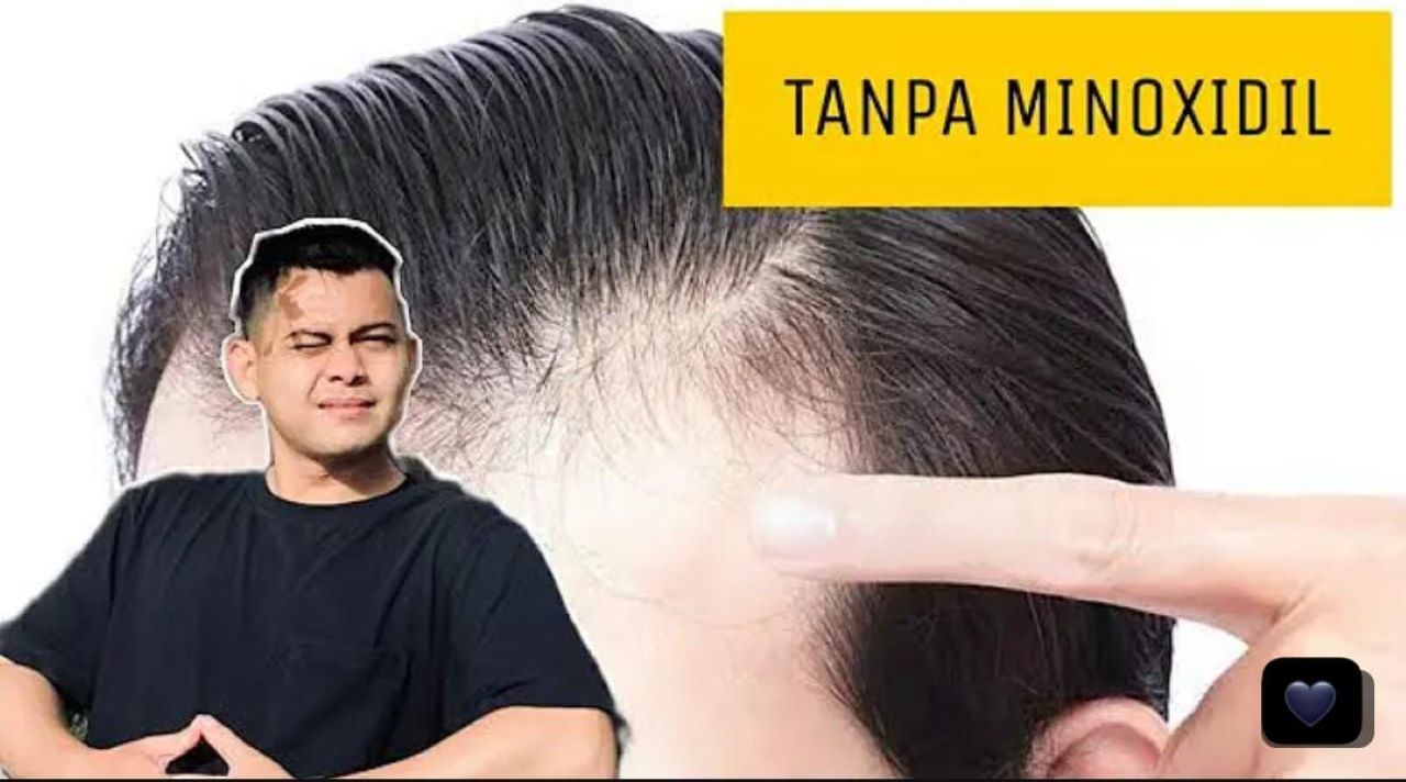 Cara Cepat Menumbuhkan Rambut Pakai Bahan Alami, Bagus untuk Menghilangkan Uban Agar Hitam Permanen