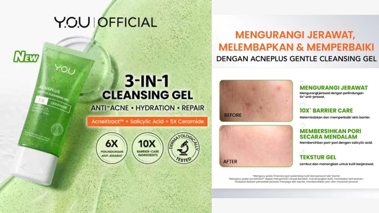 Review YOU AcnePlus Gentle Gel Cleanser, Sabun Wajah Anti Jerawat!
