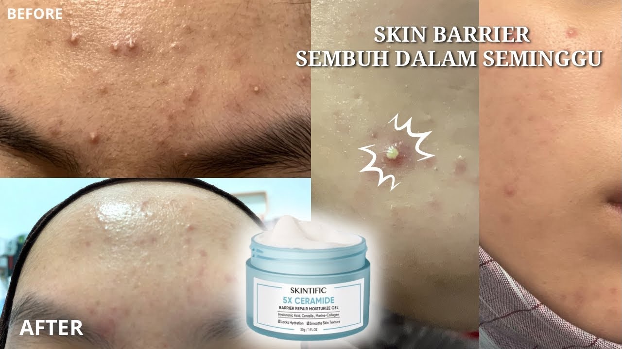 3 Produk Baru Skintific yang Bagus untuk Kulit Berminyak dan Berjerawat, Mampu Mencerahkan Kulit Gelap