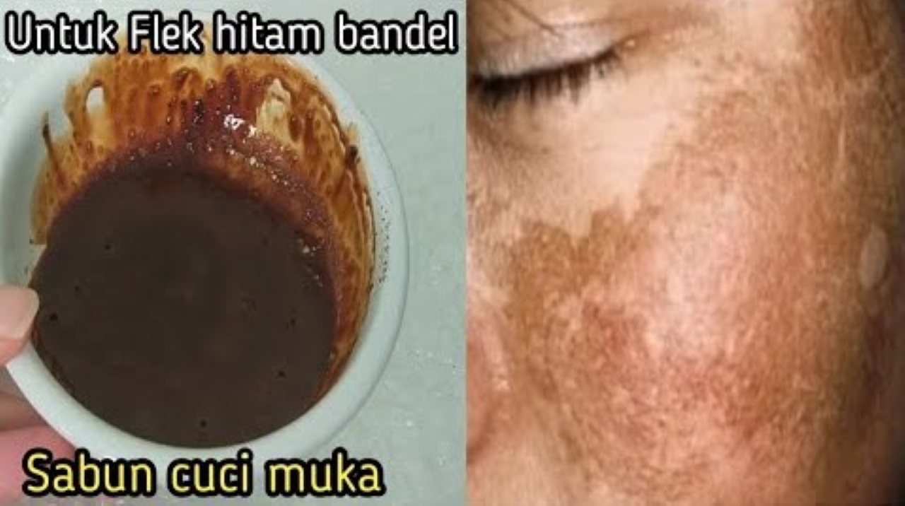 4 Sabun Wajah Penghilang Flek Hitam yang Bikin Kulit Glowing Cerah Merata 