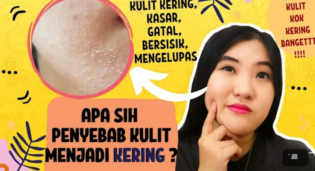 4 Cara Mengatasi Kulit Muka Mengelupas dengan bahan dapur, Wajah jadi Lembap, Kenyal dan Bebas Kerutan