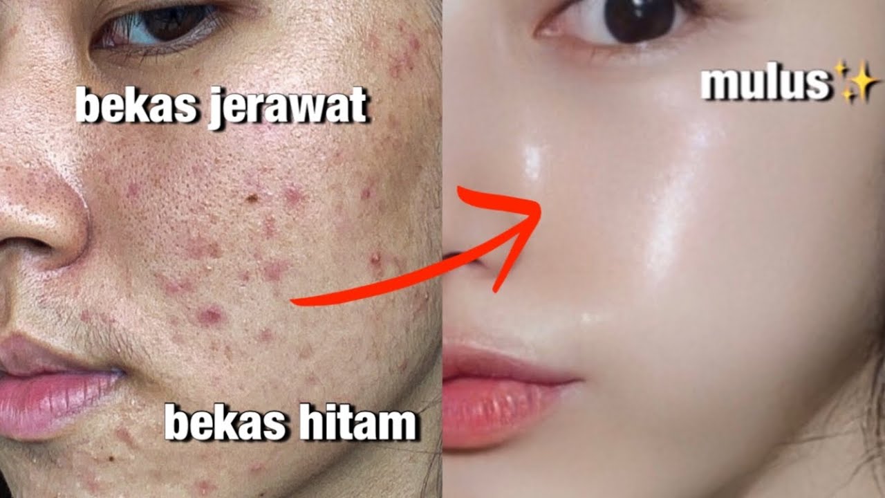 Tips Cantik dan Glowing Tanpa Skincare Saat Lebaran, Pakai 1 Jenis Bahan Alami Bonus Wajah Awet Muda