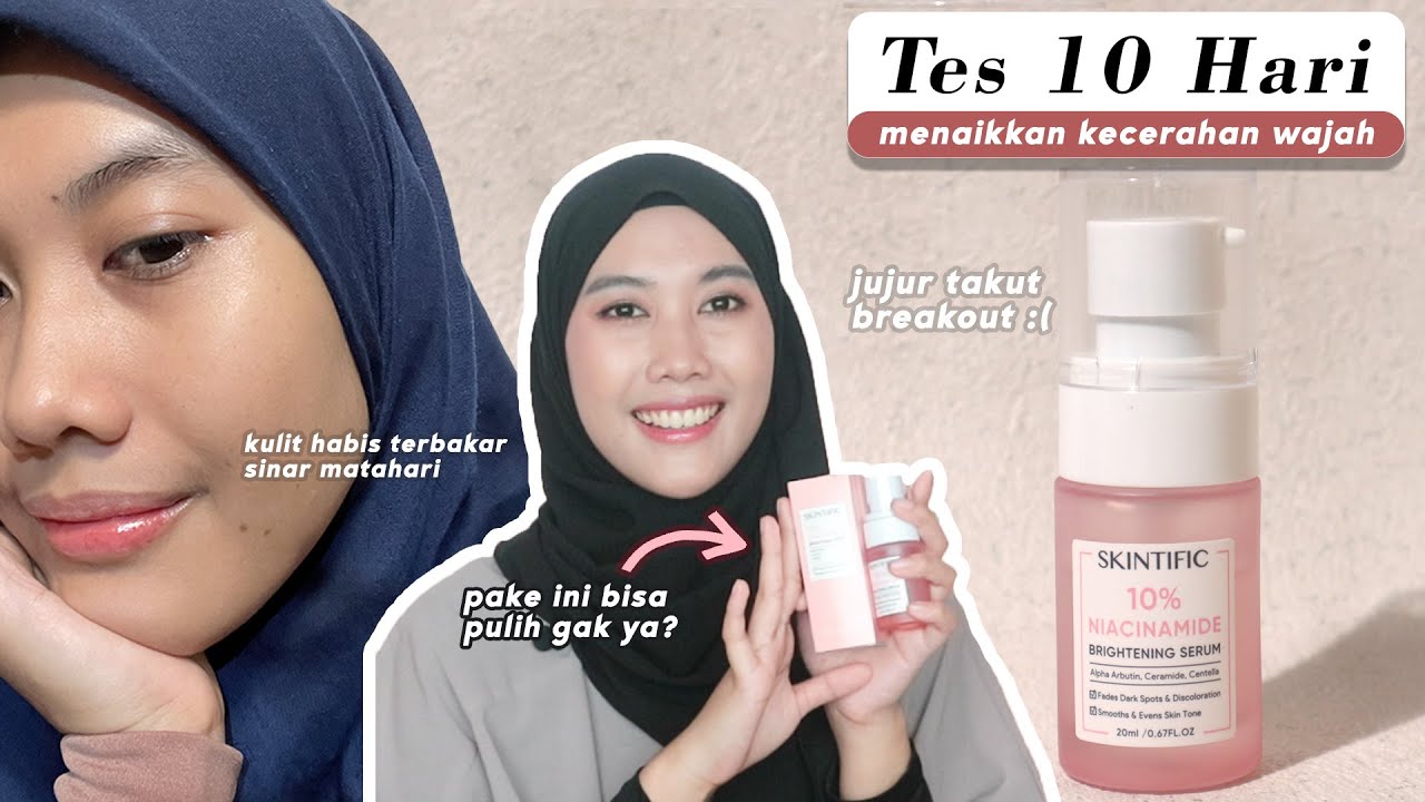 Review Jujur Serum Skintific 10% Niacinamide yang Ampuh untuk Membuat Kulit Lebih Cerah dan Glowing 