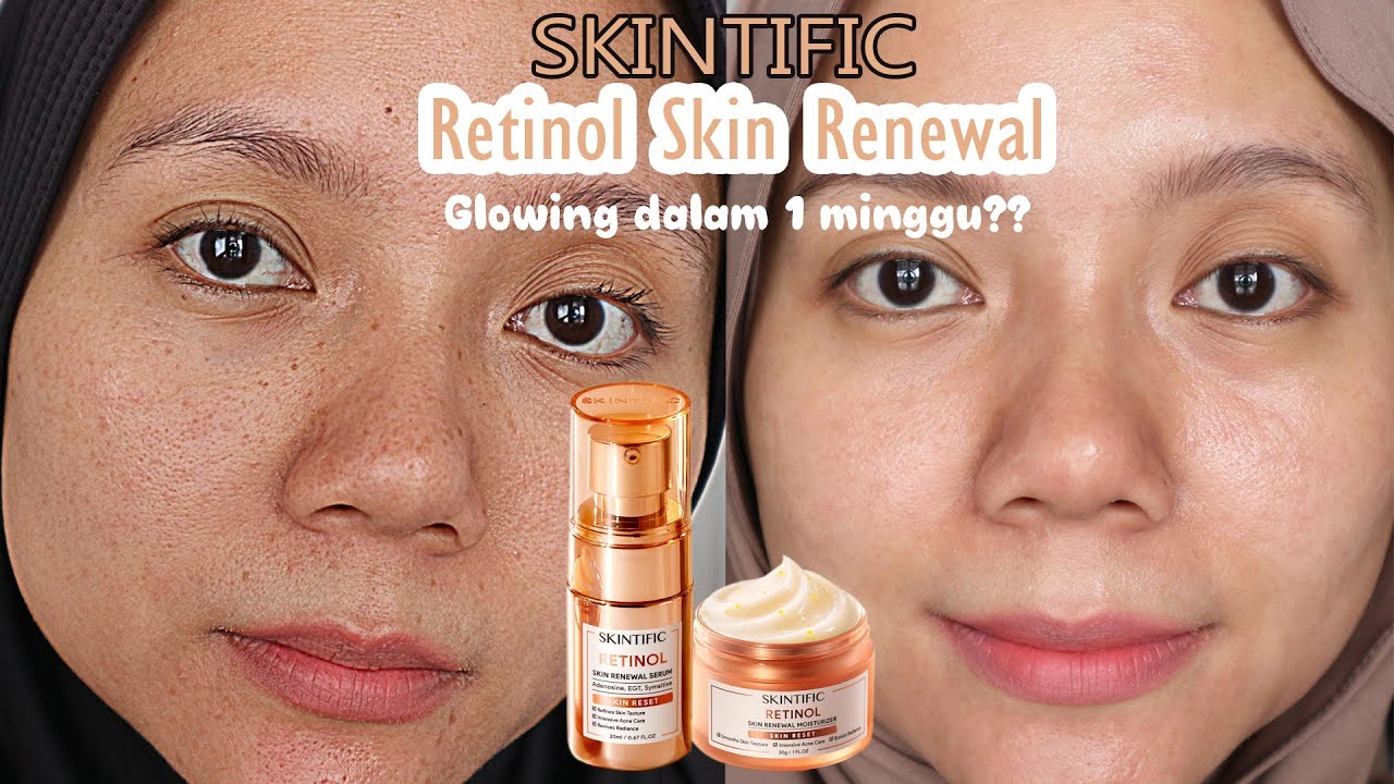 Review Hasil Pemakaian Retinol Skintific dalam 1 Minggu, Hasil Nyata Tanpa Iritasi!