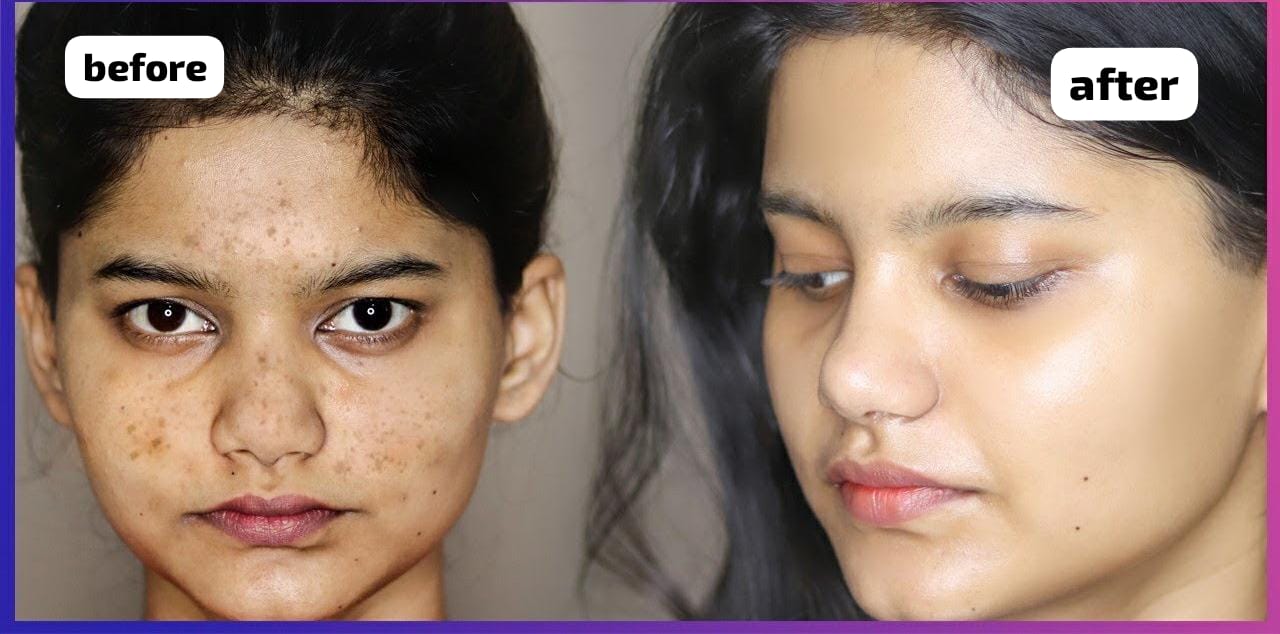 Masker Cuka Apel Bikin Flek Hitam Hilang, Begini 3 Cara Menggunakanya yang Benar Agar Wajah Glowing Permanen