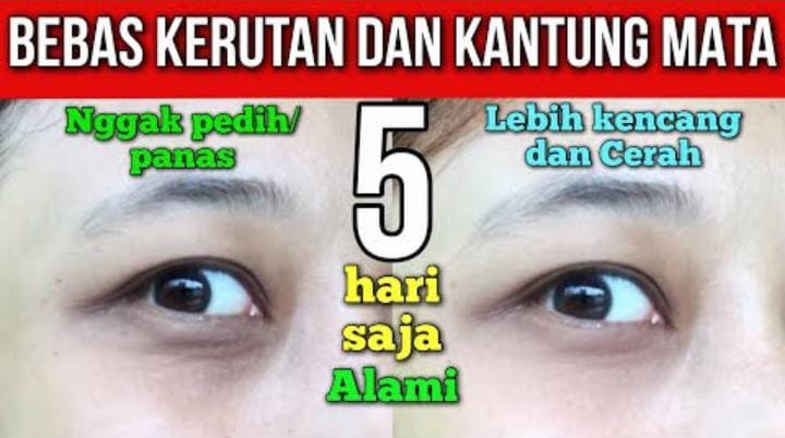 Bagaimana Cara Pakai Tomat Agar Mata Panda Cepat Memudar? Begini 5 Tips Paling Ampuh yang Harus Kamu Tau