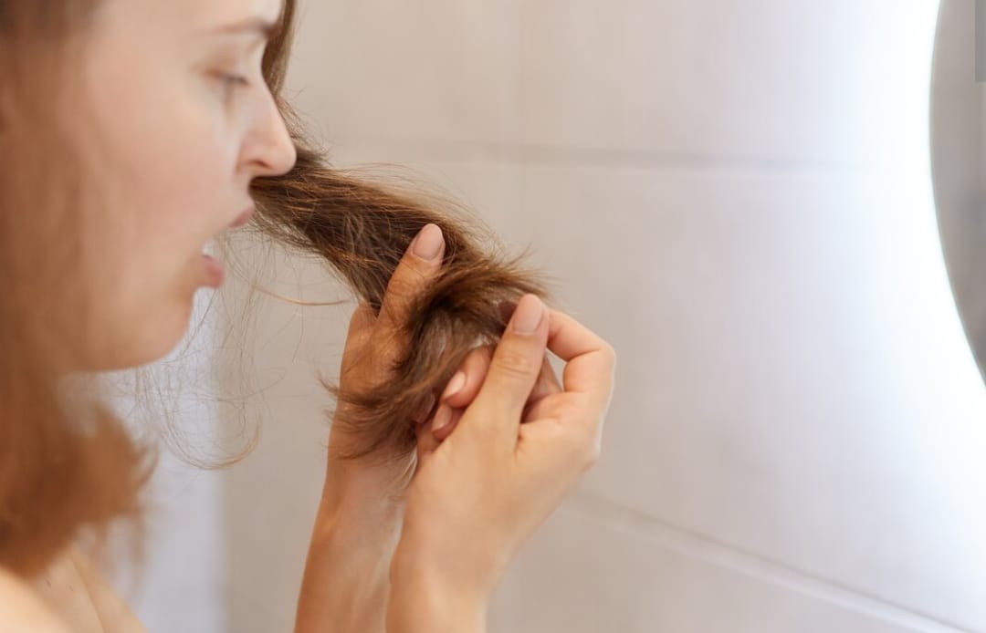 4 Cara Mengatasi Rambut Rontok Secara Alami di Rumah, Hasil Terlihat Dalam 1 Minggu