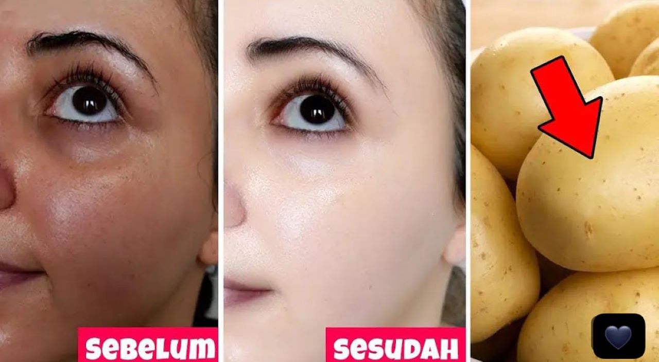 3 Cara Membuat Wajah Glowing Dengan Kentang, Ampuh Hilangkan Flek Hitam dan Kecilkan Pori-Pori