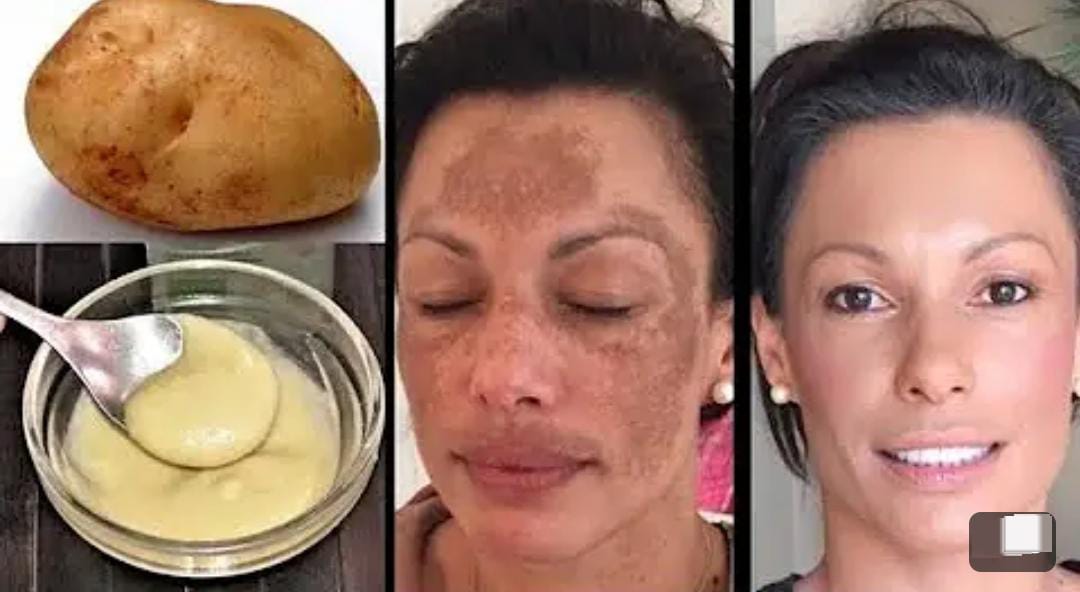 DIY Racikan Masker Wajah Glowing Tanpa Flek Hitam, Cocok Digunakan Untuk Usia 40 Tahun Ke Atas Agar Awet Muda 