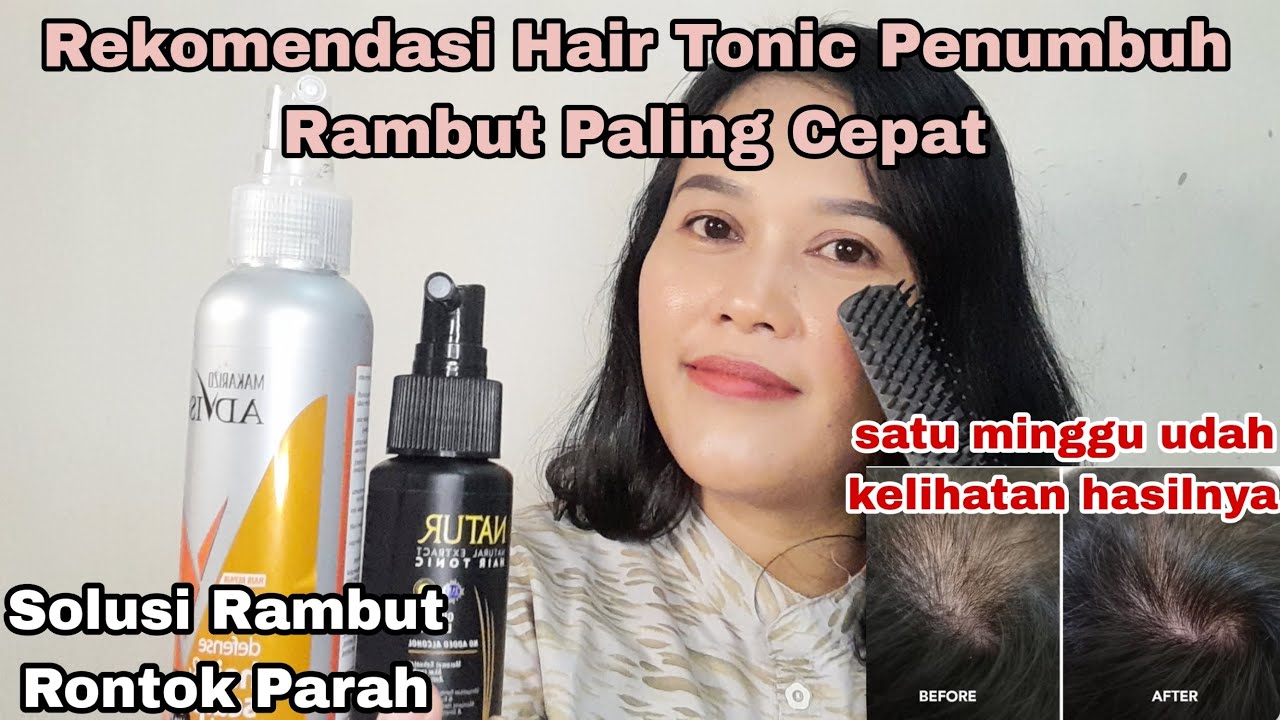 4 Hair Tonic Terbaik untuk Rambut Tipis dan Rontok, Solusi Praktis Bikin Rambut Tebal dan Sehat Bebas Uban