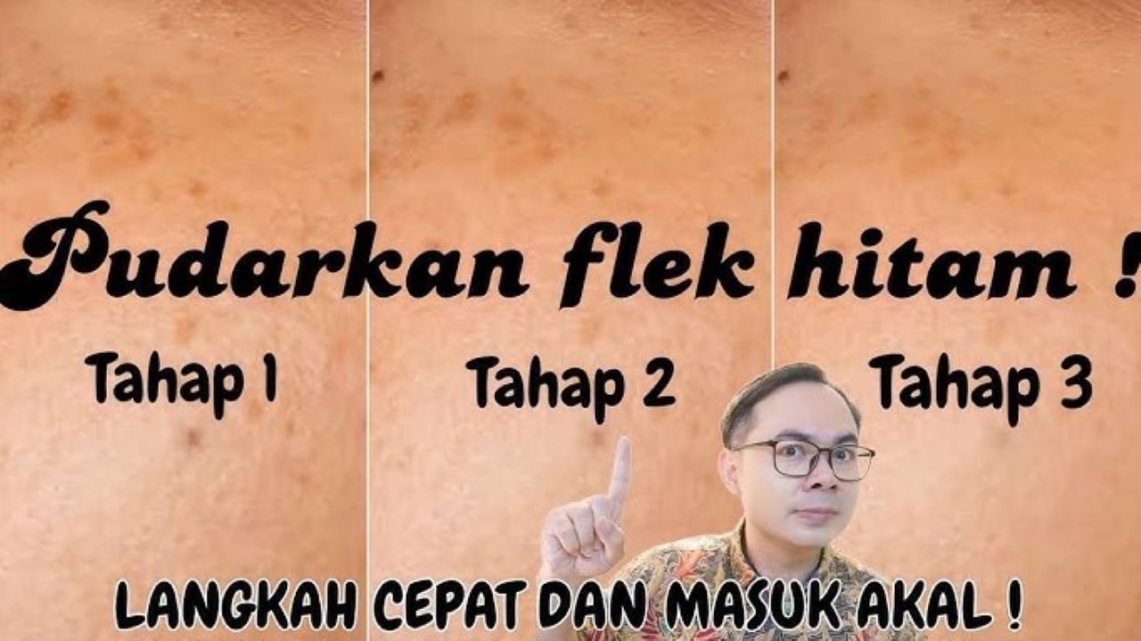 Glowing! 4 Merk Skincare Flek Hitam 2025 yang Bikin Warna Kulit Cerah Merata dan Awet Muda 