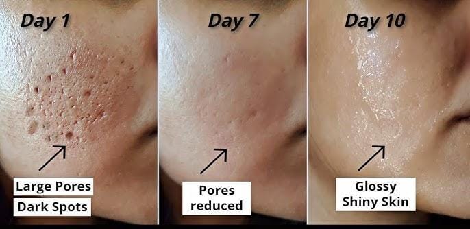 3 Cara Menghilangkan Flek Hitam dan Pori-Pori Besar di Wajah, Tips Glowing Bebas Kerutan Tanpa Skincare 