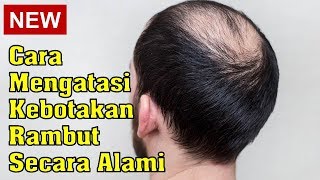 Ini Dia Bahan Alami Yang Bisa Membantu Mengatasi Kebotakan, Cukup Gunakan Jus Bawang dan Lidah Buaya