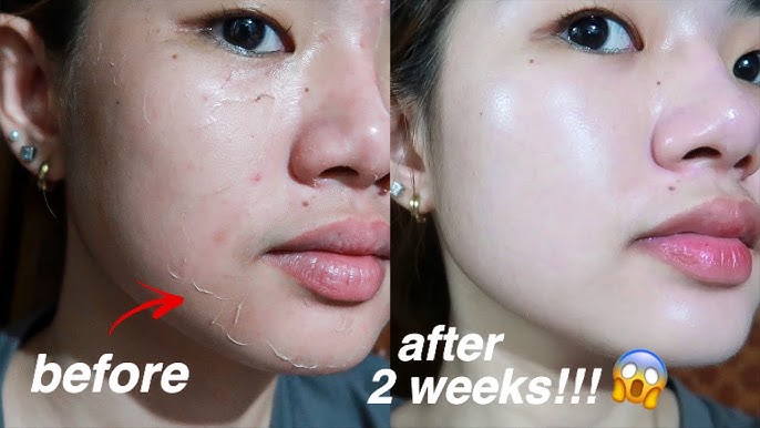 5 Skincare untuk Memutihkan Wajah dan Glowing yang Aman dan Sudah BPOM