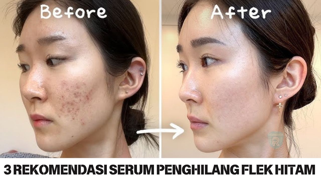 3 Rekomendasi Serum Penghilang Flek Hitam, Bikin Kulit Kencang Bebas Kerutan Langsung Glowing Sekali Pakai