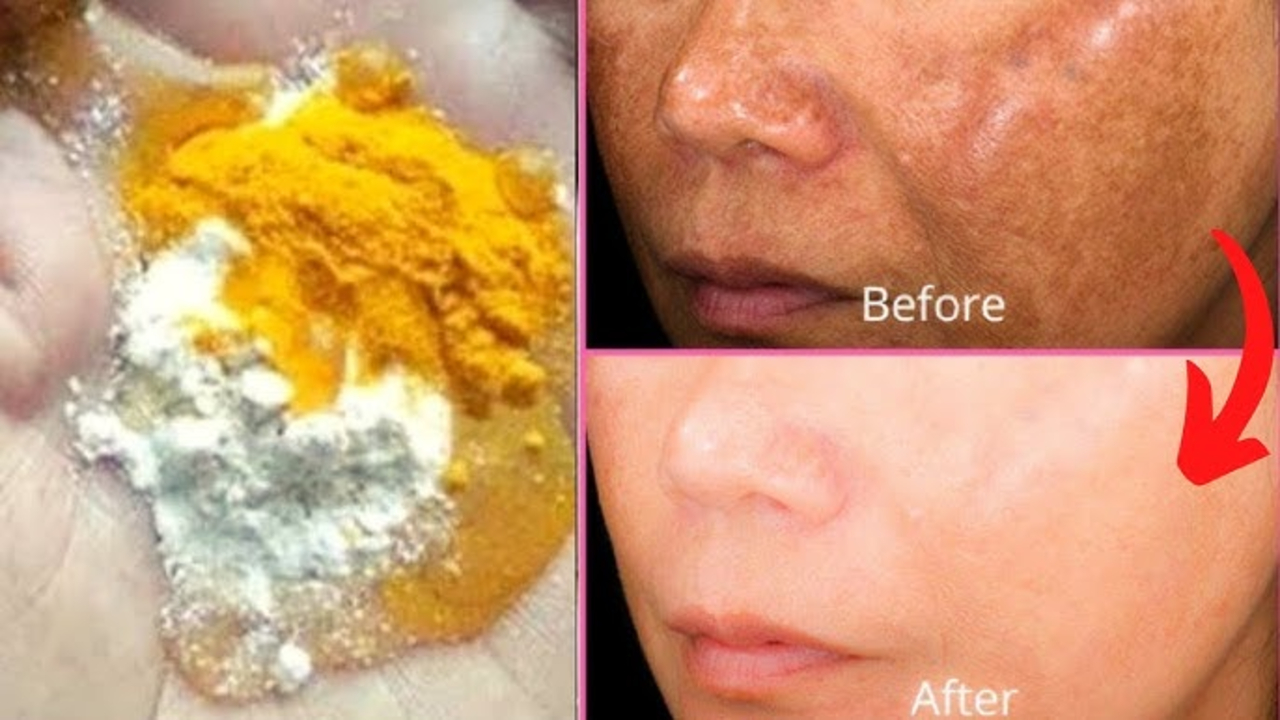 Begini Cara Memutihkan Wajah Secara Alami dan Cepat dalam 1 Hari, Ampuh Atasi Kulit Belang dan Kusam