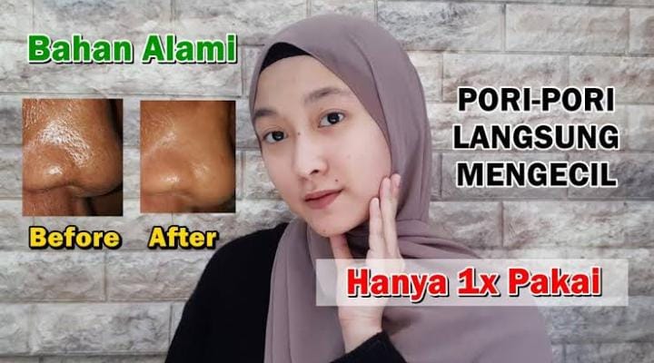 Masker Pengecil Pori-Pori untuk Wajah Berkomedo, Pakai 3 Bahan Dapur Ini Kulit Jadi Mulus Tanpa Skincare