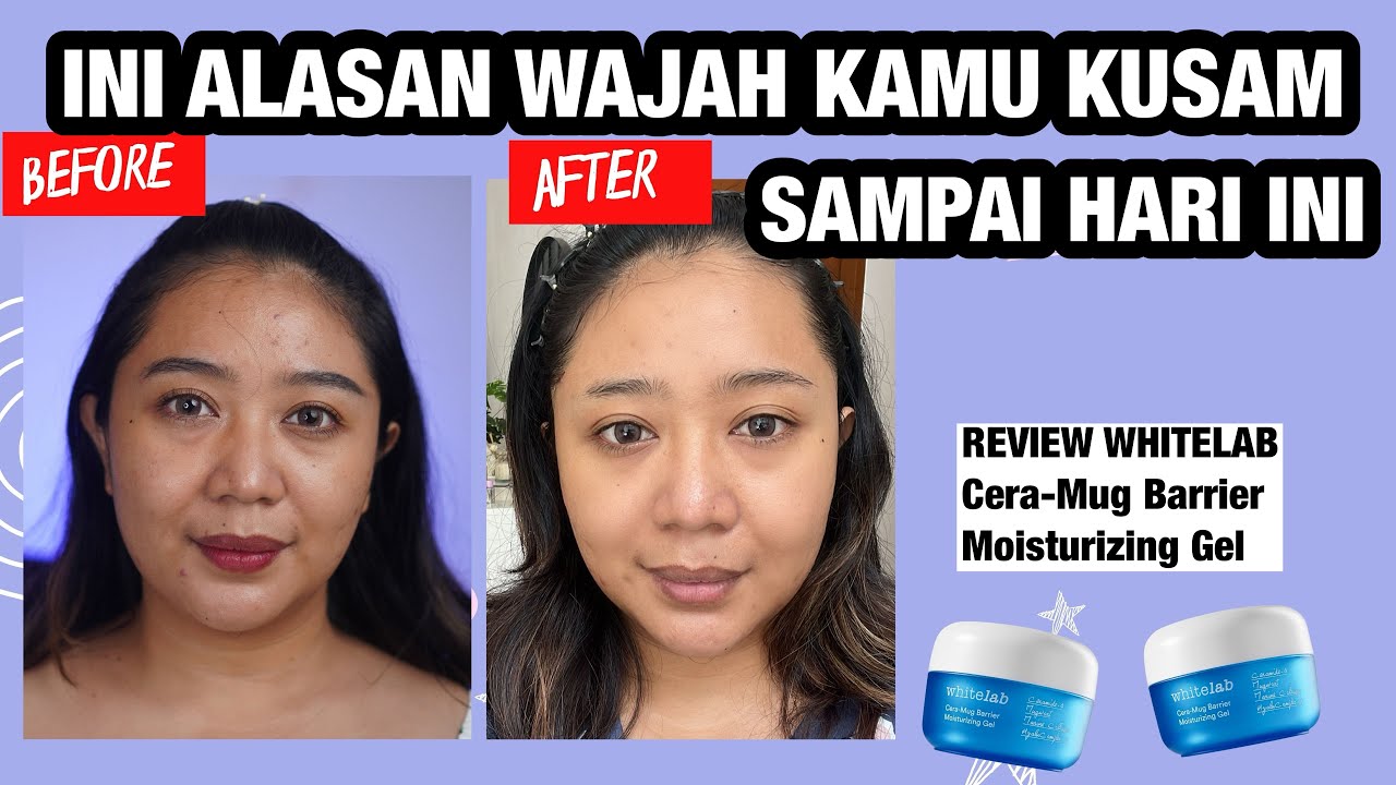 Ini Rekomendasi Moisturizer Gel yang Cocok Digunakan Saat Musim Panas Agar Bebas Gerah