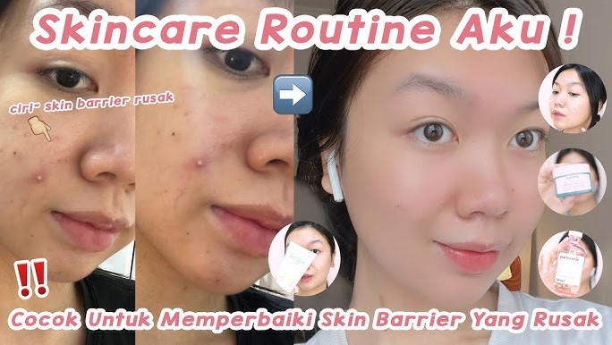 4 Merk Skincare untuk Skin Barrier yang Rusak, Bagus Nggak Sih?