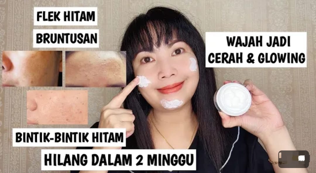 3 Produk Penghilang Flek Hitam dan Pengencang Wajah yang Kendur Terbaik, Wajah jadi Bebas Noda Hitam Permanen