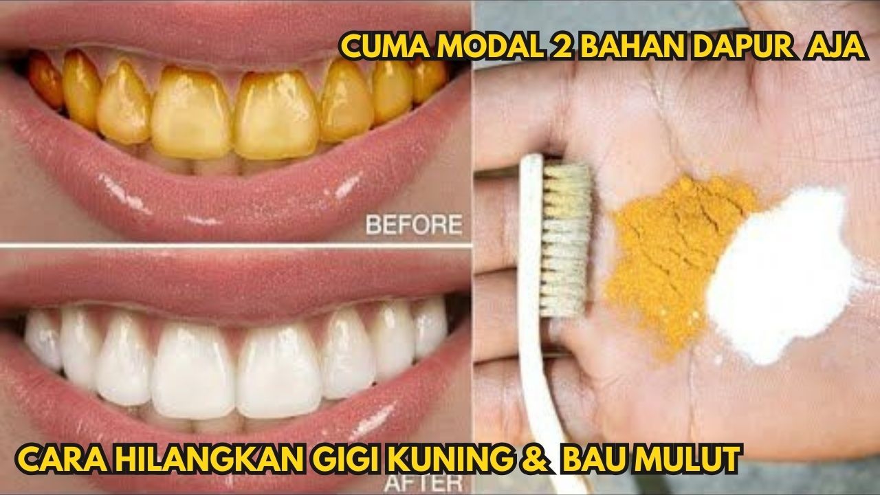 3 Cara Hilangkan Gigi Kuning dan Bau Mulut, Cuma Pakai Bahan Dapur Aja!