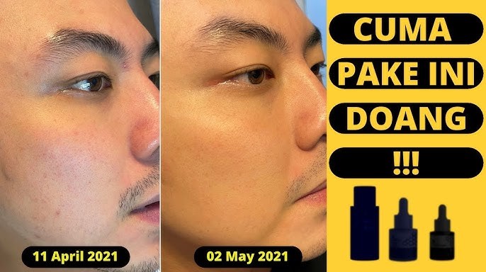 4 Rekomendasi Skincare Pria untuk Wajah Glowing, Ampuh Kecilkan Pori-Pori dan Atasi Kulit Berminyak