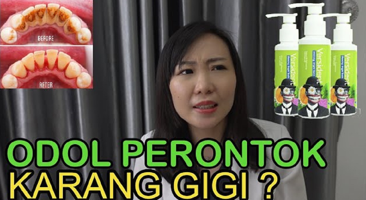 4 Merek Pasta Gigi yang Ampuh Menghilangkan Karang Gigi Membandel dalam 1 Malam, Gigi Putih Bersih Anti Karang