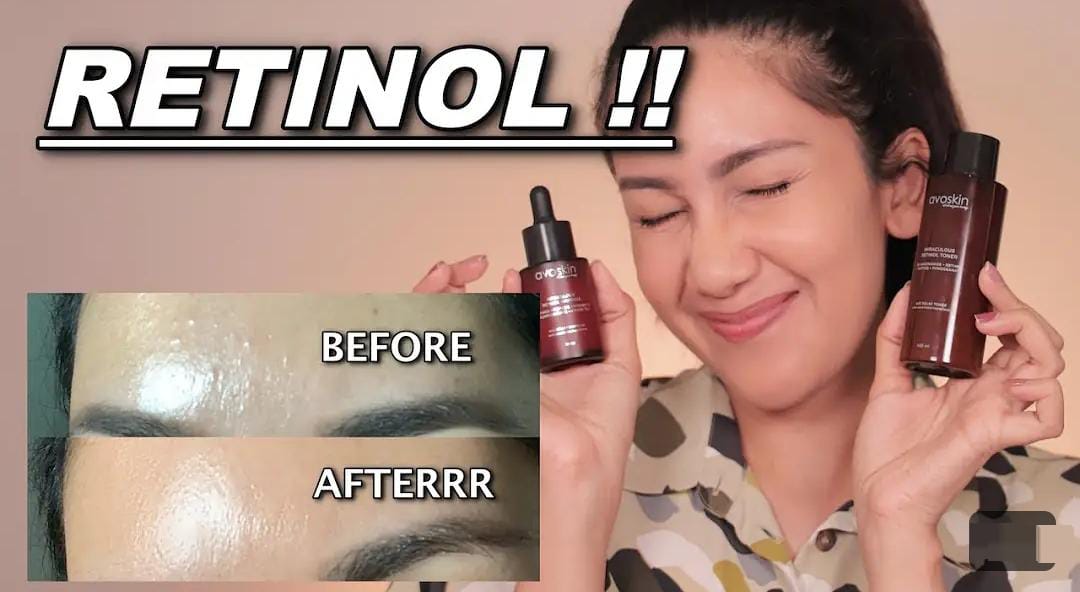 3 Serum Retinol yang Bagus untuk Wajah Usia 40 Tahun Ke Atas, Kulit jadi Glowing Bebas Kerutan dan Noda Hitam!