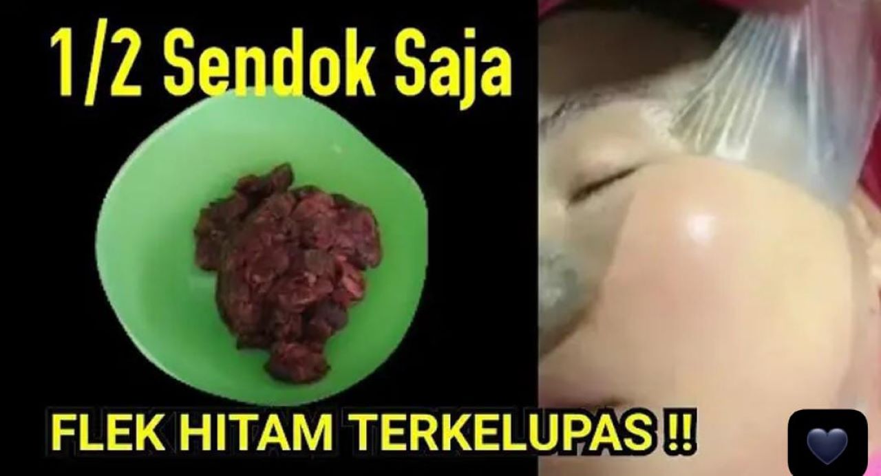 Inilah Racikan Masker Alami Penghilang Noda Hitam di Wajah dari Bahan Dapur, Ini 3 Langkah Raciknya