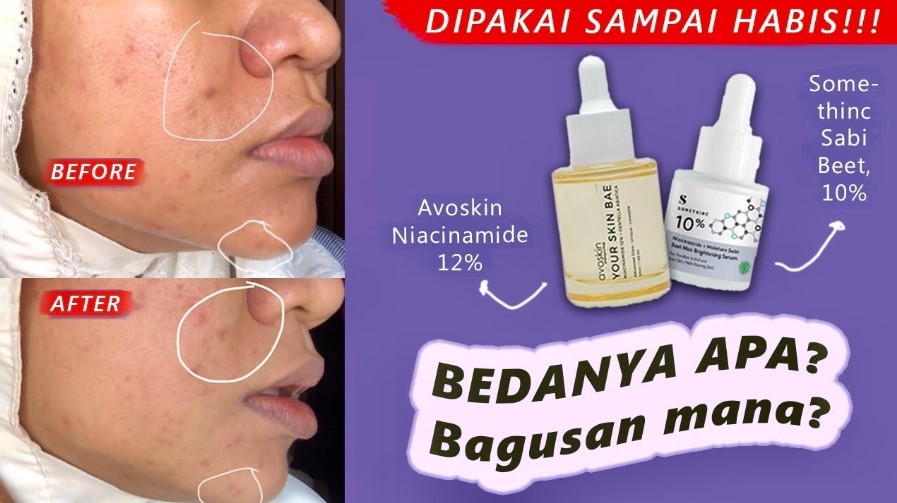 4 Rekomendasi Produk Skincare yang Mengandung Niacinamide, Bikin Wajah Cerah Bebas Noda Hitam