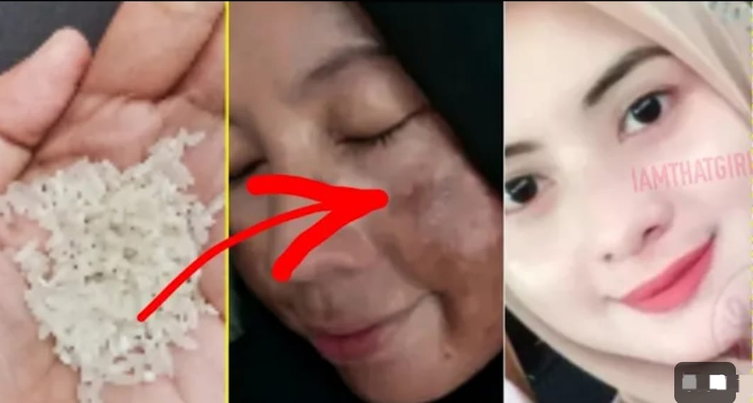 3 Masker Wajah untuk Flek Hitam Tebal dengan Bahan Dapur, Kulit Langsung Kencang Bebas Kusam dan Noda Hitam