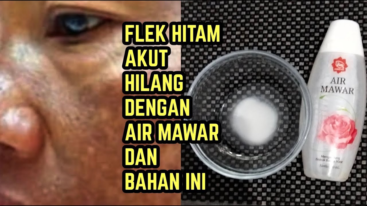 DIY Racikan Air Mawar Penghilang Flek Hitam, Tambahkan 1 Bahan Ini Wajah Glowing dalam 1 Malam