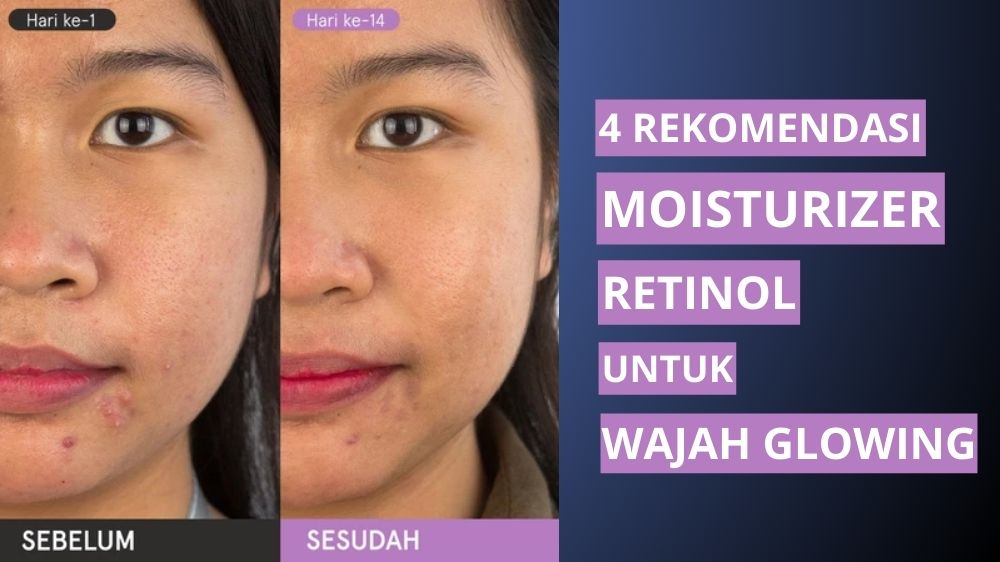 4 Rekomendasi Moisturizer Retinol untuk Wajah Glowing dan Mulus, Bantu Memperbaiki Kerusakan Kulit