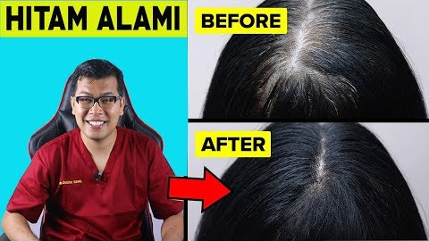 3 Manfaat Minyak Kayu Putih untuk Uban dan Cara Pakainya yang Efektif Hitamkan Rambut Dalam Sekali Oles!