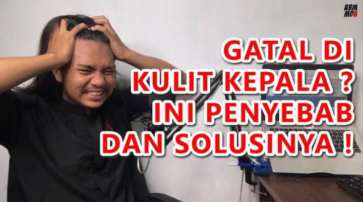 3 Cara Mengatasi Gatal di Kulit Kepala Pakai Bahan Alami, Rahasia Rambut Sehat dan Bersih Tanpa Ketombe