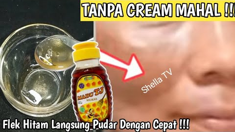 2 Cara Gampang Menghilangkan Flek Hitam dengan Madu, Bikin Kulit Kencang dan Glowing Bebas Kusam