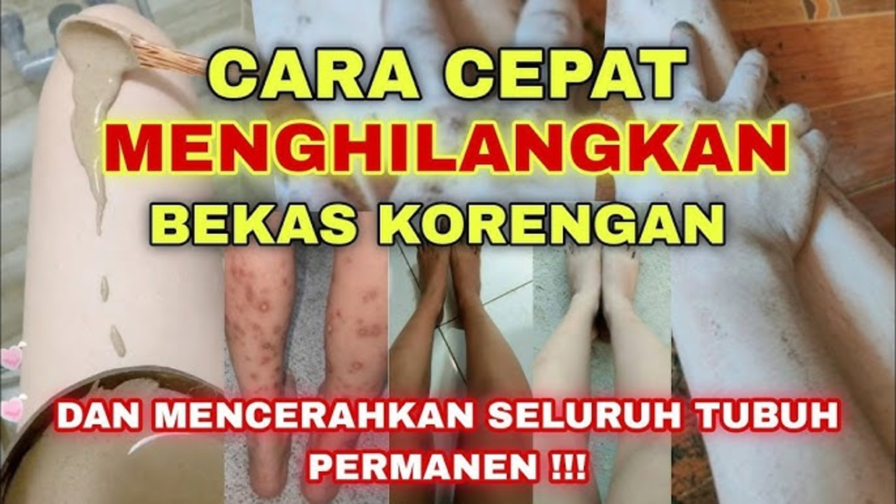 DIY Obat Penghilang Bekas Luka Koreng yang Menghitam, Cuma Pakai 1 Bahan Ini!