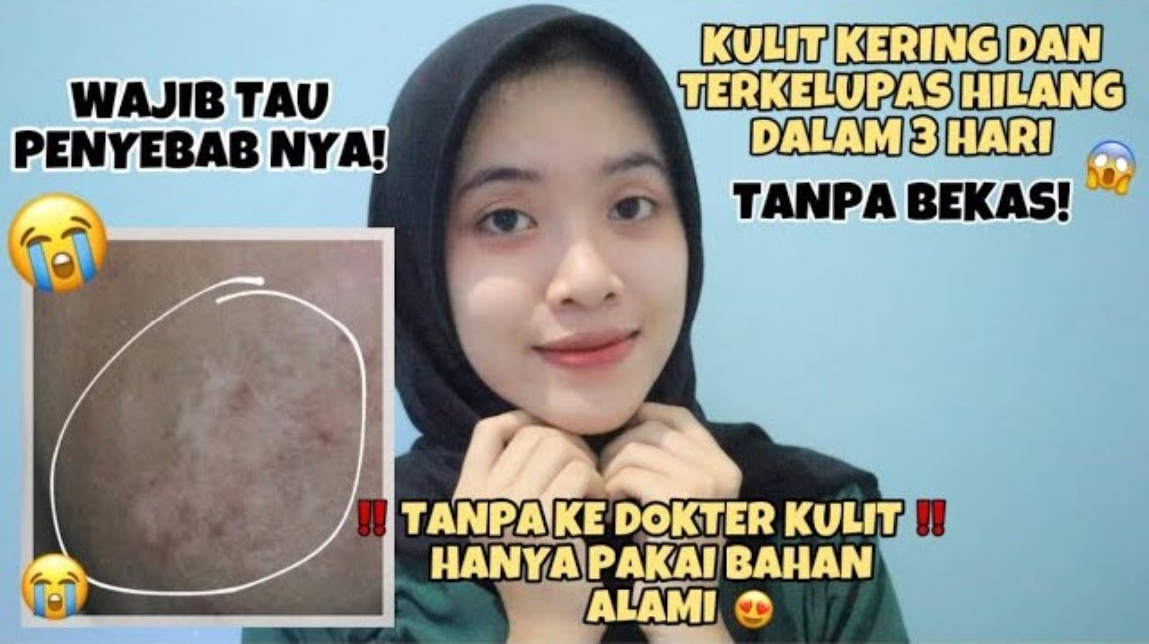 Cara Mengatasi Kulit Kering Agar Tidak Mudah Menua, Perawatan Simpel dengan 2 Bahan Alami