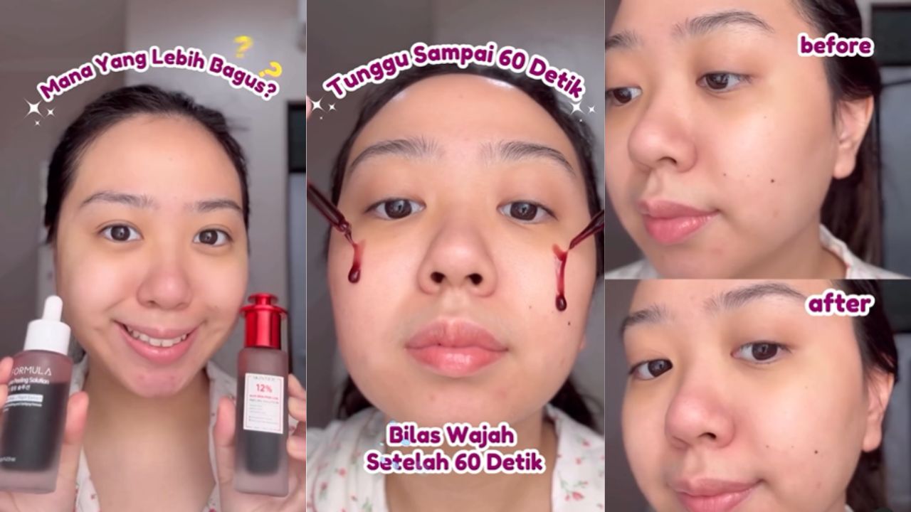 Battle Review Peeling Solution Viral antara Skintifiv Vs Elfromula, Mana yang Paling Bagus?