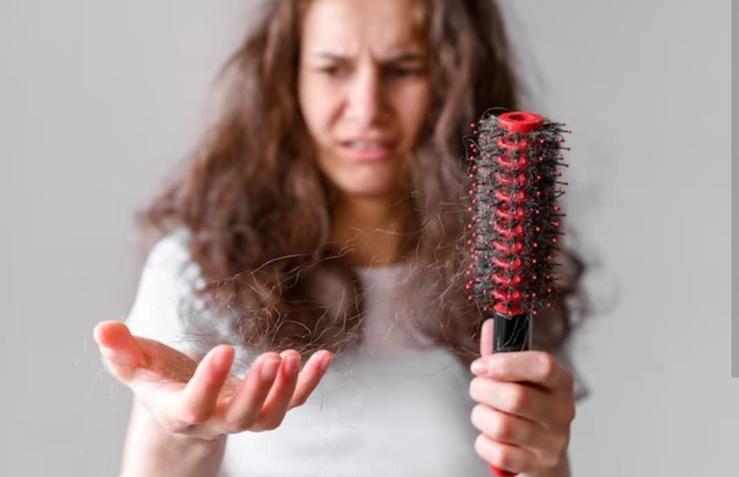 6 Solusi Rambut Rontok Parah Ini Bikin Rambut Jadi Lebat Permanen Lho! Kamu Sudah Coba?