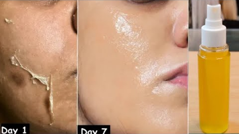 Begini Cara Membuat Wajah Glowing Bebas Flek Hitam dengan Cuka Apel, Cuma 3 Langkah Mudah Tanpa Iritasi 