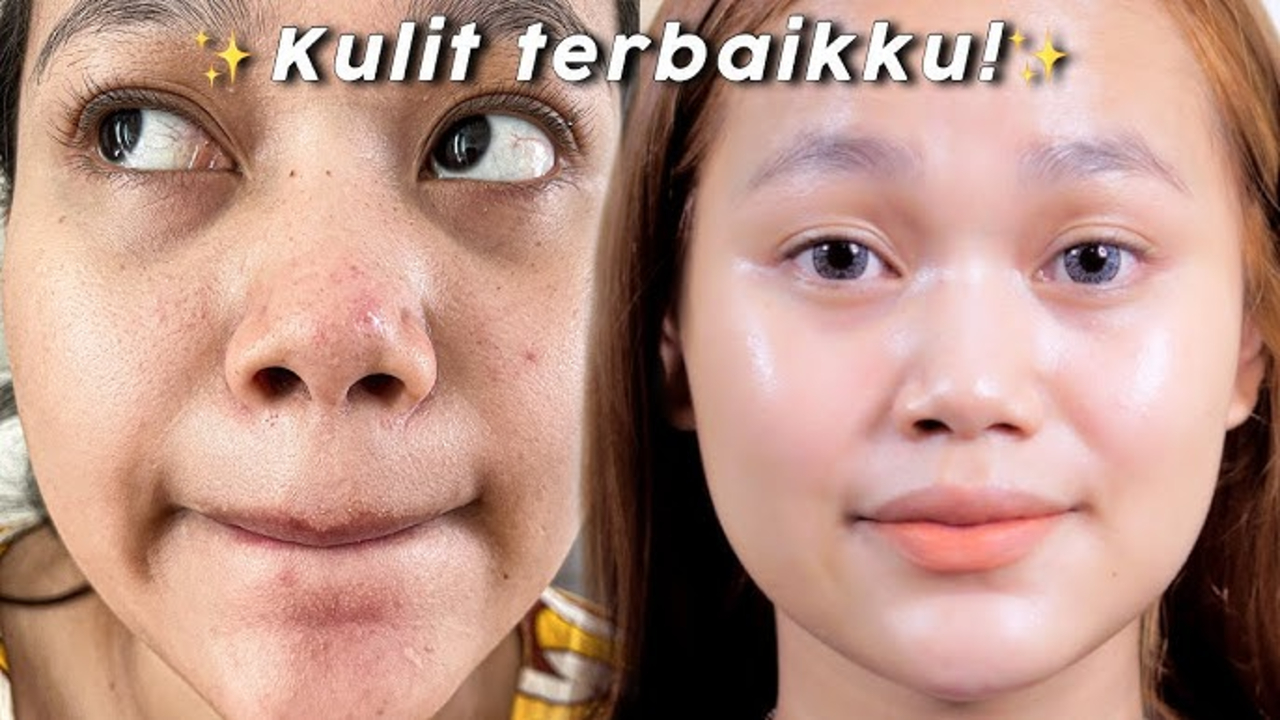 5 Produk NPURE untuk Flek Hitam Terbaik, Cocok Digunakan Usia 50 Tahun Ke Atas!