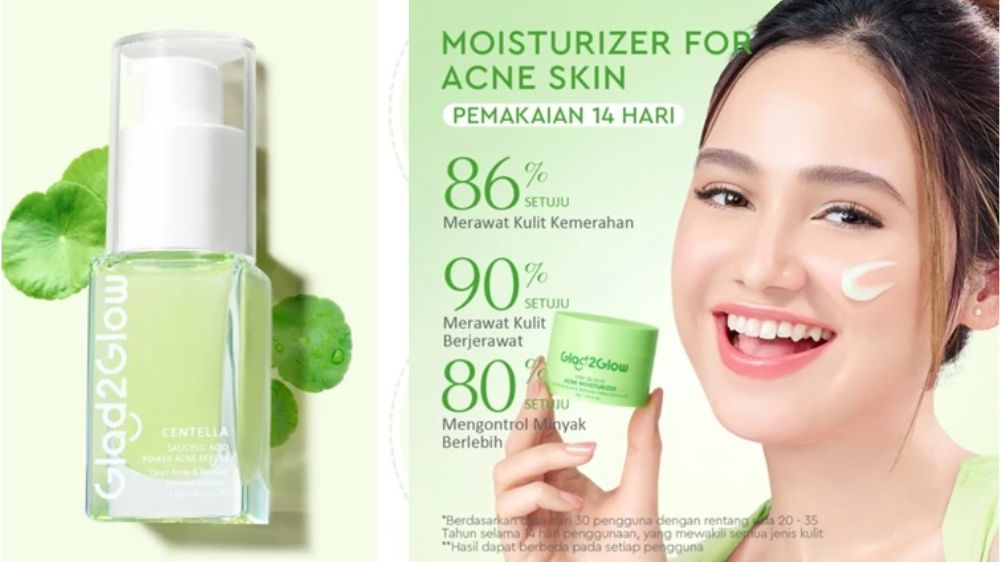 4 Produk Glad2glow untuk Kulit Berjerawat, Efektif Menenangkan Sampai Cegah Muncul Kembali