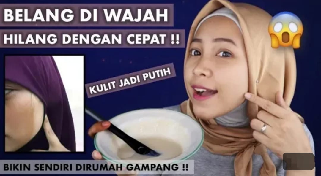 4 Cara Menghilangkan Kulit Belang di Wajah Dalam 1 Hari Pakai Bahan Dapur, Sekali Oles Wajah Kenyal Glowing