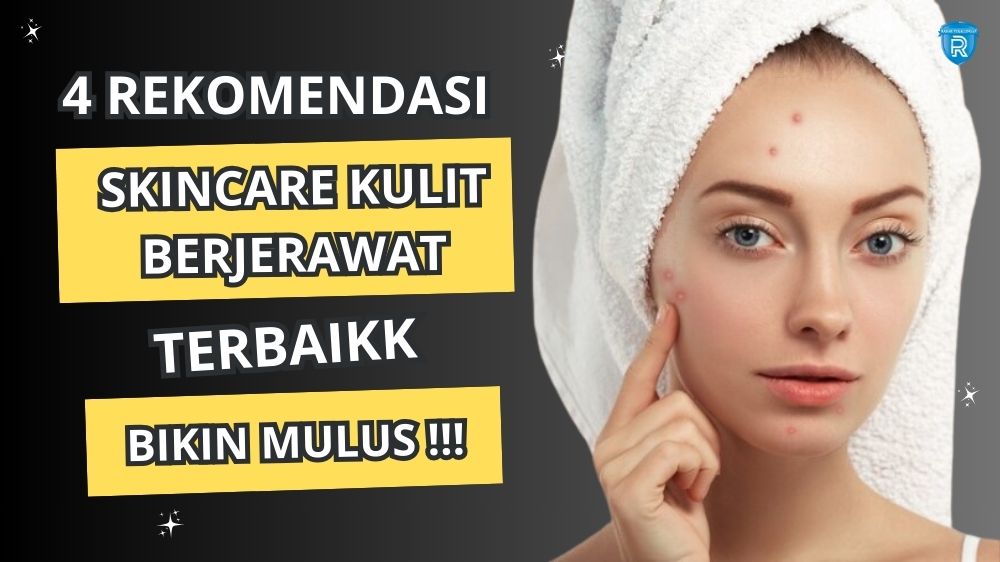 4 Rekomendasi Skincare untuk Kulit Berjerawat yang Bikin Mulus, Nyaman di Wajah