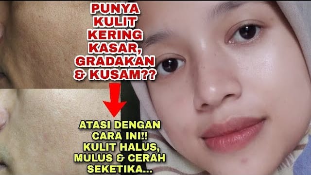 3 Petunjuk Cara Pakai Minyak Zaitun dan Gula Pasir untuk Wajah, Efektif Hilangkan Flek Hitam dan Kerutan